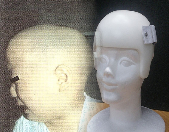 ‘지오크리에이티브’의 자세성 머리기형을 교정해주는 ‘지오헬멧’