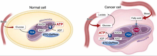 정상제포 (좌측). 암세포 에너지 대사 과정애서 지방산을 이용해 ATP를 생산하는 모습 (우측) / 논문발췌