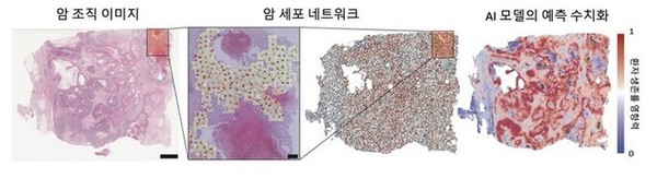 그래프기반 인공지능(AI) 딥러닝 기술 적용 암세포 분석 모습. / 서울대 