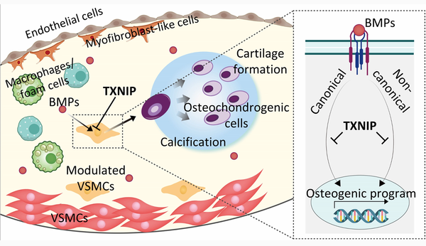혈관 평활근 세포에서 골/연골세포 분화의 주 기전인 BMP 억제하는 TXNIP 모식도
