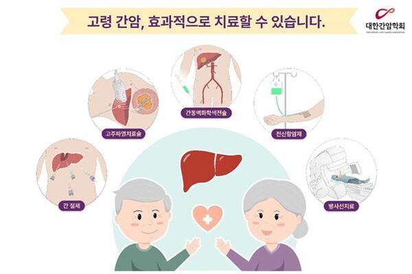그래픽=대한간암학회 제공