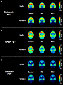 실험을 통한 글루타메이트, 가바, 세로토닌 수치 변화 PET이미지 / 논문발췌