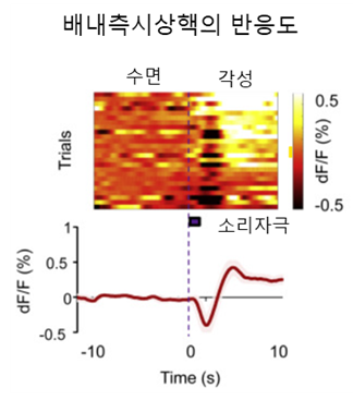 소리자극에 반응하는 GRIK4 배내측 신경. 소리자극이 주어진 시점을 기준으로 GRIK4 배내측 신경의 활성도가 증가하면서 각성효과가 유도
