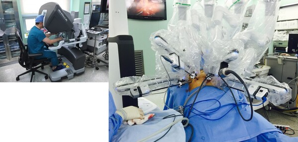 로봇수술 모습. 사진=서울성모병원 제공