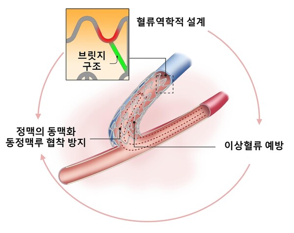 브릿지 구조 설계로 이상혈류 예방하는 투석혈관 조성술 기기 모식도 /연대 의대
