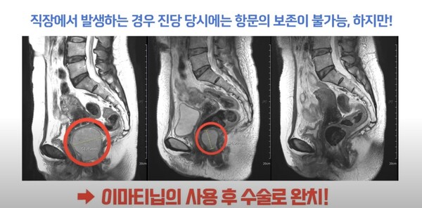 사진 캡처=유튜브 채널 '강북삼성병원'
