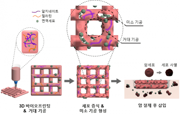3D 바이오프린팅 NK 세포 면역 치료과정 / 생명연