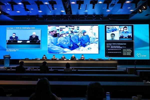 제11회 심장판막 및 구조 심질환 중재시술 국제학술회의(AP VALVES & STRUCTURAL HEART 2023) 모습. 사진 제공=서울아산병원