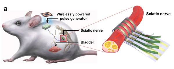 (a) 과민성 방광 치료를 위한 전자약 시스템 및 (좌골)신경 인터페이스 모식도