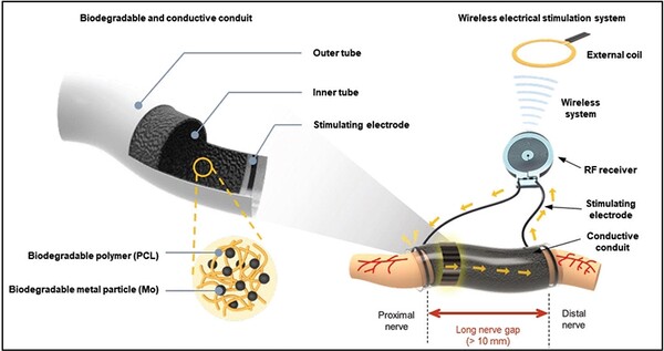 무선으로 전력을 공급받아 전달하는 전자약 모식도 / 논문발췌