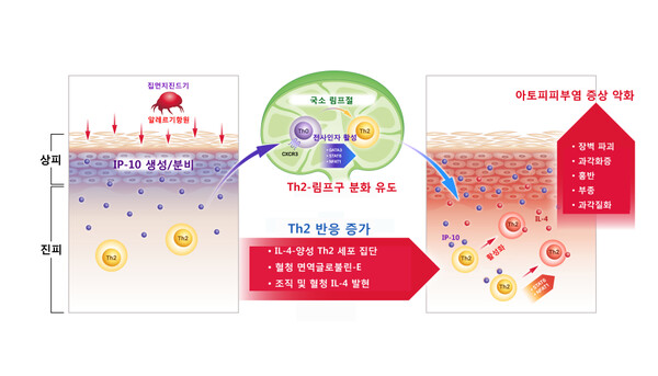 집먼지진드기 민감성 아토피피부염에서 IP-10의 생산과 그 작용 기전