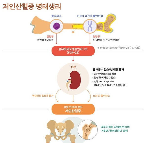 ‘만성 특발성 저인산혈증’의 발생 기전(2022 대한내분비학회 희귀질환연구회 FACT SHEET)]