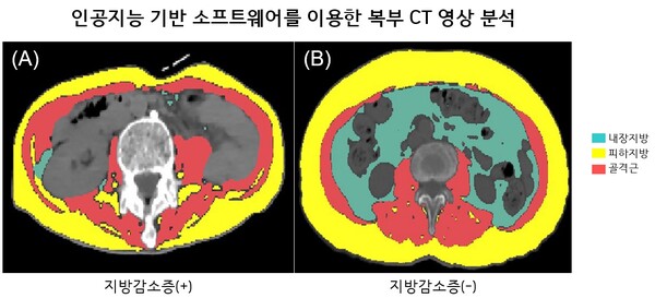 그래픽 제공=서울대병원