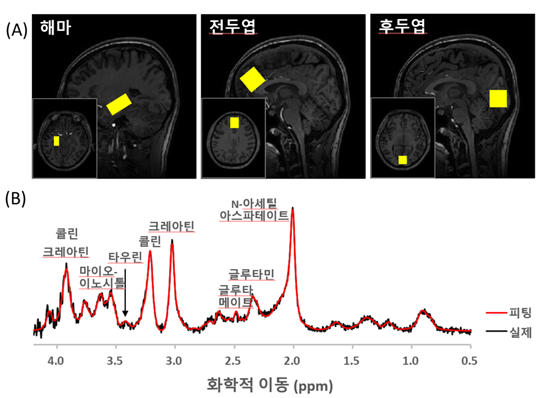 (A) 스펙트럼을 측정한 뇌 부위(노란색 박스)와 (B) 해마에서의 1H MR 스펙트럼_해마의 타우린 신호는 3.4 ppm 위치(화살표)에서 확인할 수 있음. 검은색 선은 실제 측정한 스펙트럼이고, 붉은색은 측정 데이터에 대한 LCModel 피팅 스펙트럼