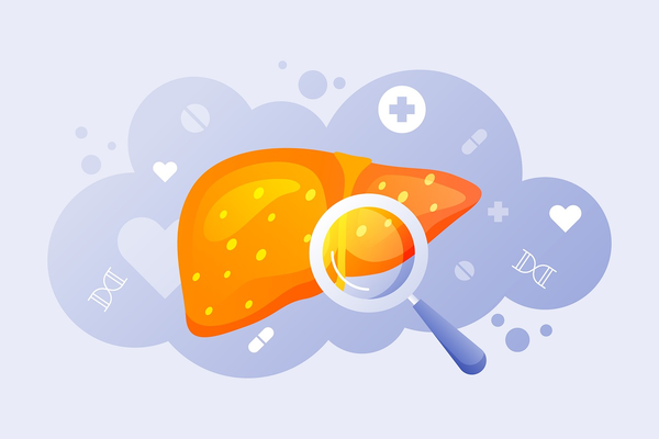 간암 수술 뒤에는 조심해야 할 식습관이 있다. 수술 뒤 축난 몸의 회복을 위해 건강에 좋다고 회자되는 다린물, 엑기스 등을 섭취하는 것인데, 간암 수술 뒤 이같은 식습관은 금물이다. 사진 출처=게티이미지