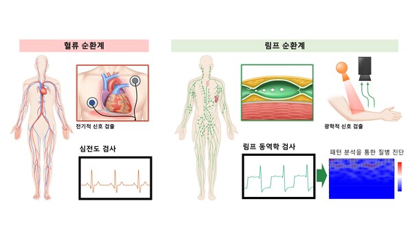 림프 동역학 검사법은 형광 림프 조영제를 체내로 주입해, 림프관으로 들어간 형광 조영제가 림프관 마디 수축 시 림프액과 함께 다음 마디로 이동하는 패턴을 광학적 측정 장비로 측정하고, 심전도 검사처럼 그래프로 신호화해 나타낸다. 그래픽 제공=서울아산병원