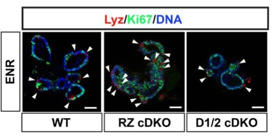 담 단백질의 역할을 규명하기 위한 오가노이드학 실험 결과, Rnf43 단백질이 없을 때, 파네스 세포가 증가한 반면, 담(Daam1, Daam2) 단백질이 없을 때 파네스 세포가 감소 / 가톨릭대 