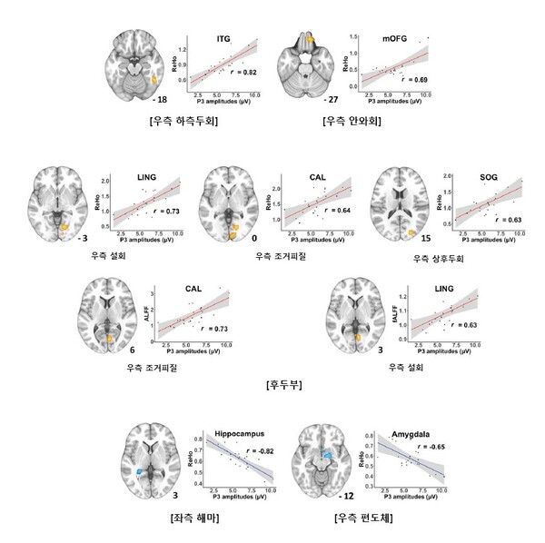기능성 MRI와 뇌파검사 결과 우측 하측두회, 우측 안와회 및 일부 후두부에서 모두 유의미한 양의 상관관계를 보였다(노란색/빨간선). 좌측 해마와 우측 편도체에서는 두 검사 결과 사이의 음의 상관관계를 보였다(파란색).