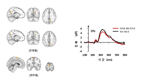 기능성 MRI 검사 결과 인터넷 게임 중독군은 정상대조군보다 두정엽과 전두엽 부위에서 뇌 활성이 증가했다. 청각 자극에 대한 뇌파 신호의 진폭은 인터넷 게임 중독군이 정상대조군보다 감소했다