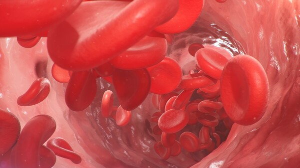 전체 림프종 가운데 가장 흔한 혈액암인 '미만성 거대 B세포 림프종(Diffuse Large B Cell Lymphoma, DLBCL)'은 흔히 치료 성적이 나쁘다는 오해가 많다. 사실 대부분의 혈액암은 예후가 좋지 않은 편인데, DLBCL의 치료 성적은 그 가운데 나쁘지 않다. 이미지 출처=게티이미지