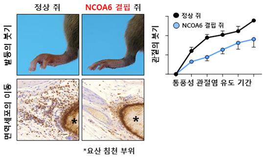 NCOA6 유전자가 결핍된 생쥐에서 통풍성 관절염이 감소 됨.