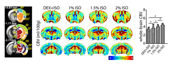 덱스메데토미딘+아이소플루레인(0.3%), 아이소플루레인(1%, 1.5%, 2%) 등 4가지 마취 조건에서 뇌 혈류지표를 측정·계산해 쥐 MRI 뇌 영상에 맵핑한 영상과 수치 결과 / 기초과학연구원