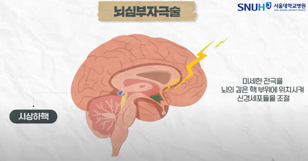 그래픽 제공=서울대병원
