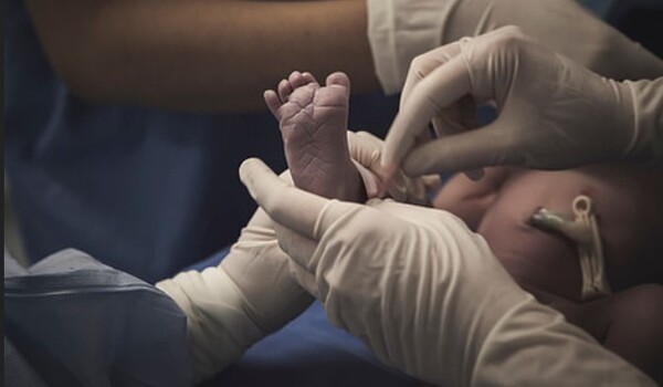 FOP는 무지외반증 형태의 엄지발가락 모양을 통해 신생아 때 조기 발견이 가능하다. 조기 발견으로 조심스럽게 생활해 다치는 것을 피하기만 하면 장애를 막을 수 있고, 다쳐서 근육에 염증이 시작된 직후 24시간 내 고용량 스테로이드를 정맥주사하면 근육이 뼈로 변하는 것을 어느 정도 차단할 수 있다. 조기 발견만 되면 골화를 막을 2번의 기회를 얻게 되는 셈이다. 사진 제공=게티이미지