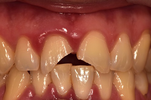 이미지 출처=서울대치과병원