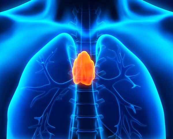 흉선종. 이미지 출처=게티이미지