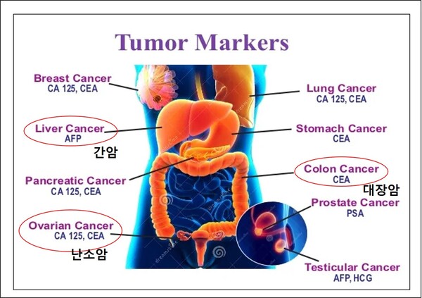 그림1. 그래픽 제공=송교영 교수