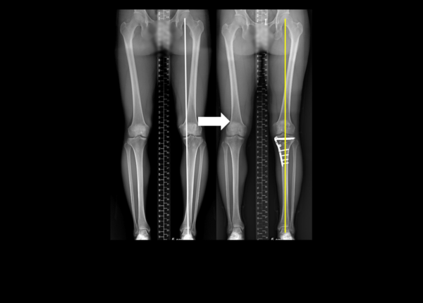 사진 제공=건국대병원
