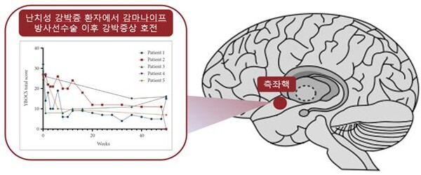그래픽 제공=서울대병원