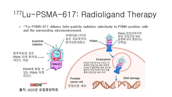 전립선암 PSMA 타겟 방사성리간드 치료