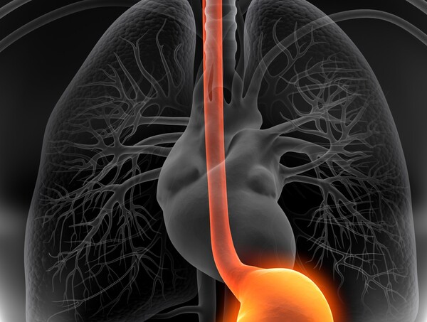 식도. 이미지 출처=게티이미지