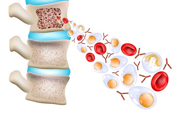 이미지 출처=게티이미지