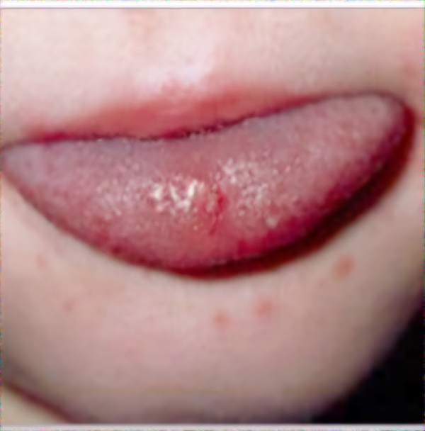 ��������. ���� ����=��������û