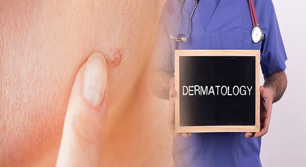 최근 늘고 있는 공격적인 성격의 희귀피부암이 있다. 바로 메르켈세포암(Merkel Cell Carcinoma, MCC)이라고도 불리는 '메르켈암'이다. 이미지 출처=게티이미지