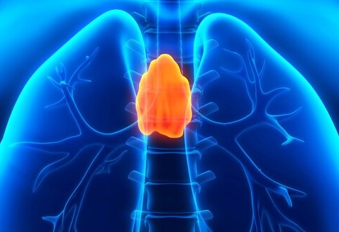 종격동 종양 중 하나인 흉선종. 이미지 출처=게티이미지