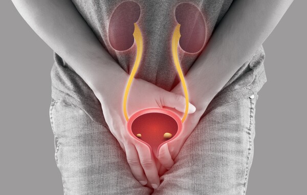 수술 불가 방광암에 최근 치료 선택지가 생겼다. 과거에는 세포독성항암제를 쓰는 것 외에 방법이 없었지만, 최근에는 보험 급여까지 되는 '세포독성항암제 치료 후 면역항암제 요법' 선택지가 생겼고, 여기에 더해 보험 급여가 아직 적용되지는 않지만 '항체약물접합체+면역항암제 병용치료'도 해볼 수 있게 된 것이다. 이미지 출처=게티이미지