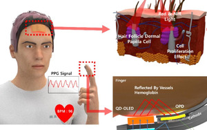 탈모 치료하는 웨어러블 양자점-OLED 패치 개발 - 뉴스 썸네일 이미지